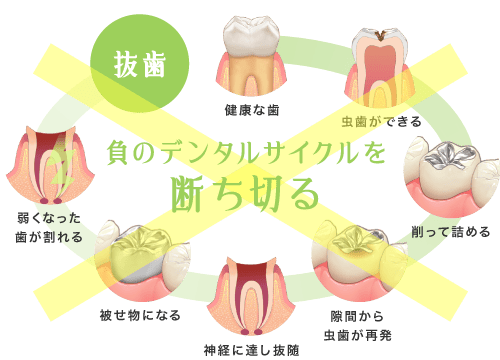 負のデンタルサイクルを断ち切る