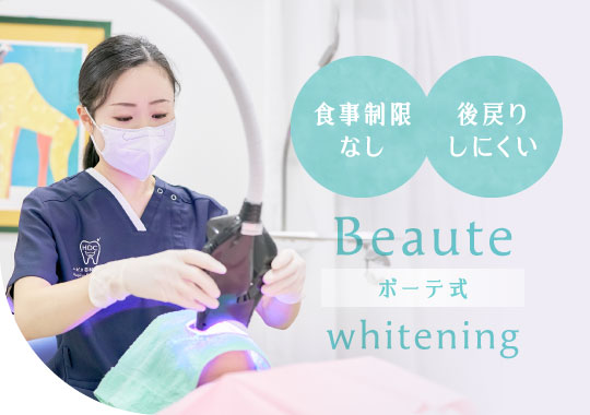 ボーテ式ホワイトニング　食事制限なし・後戻りしにくい