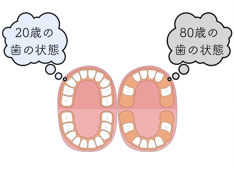 20歳の 歯の状態
