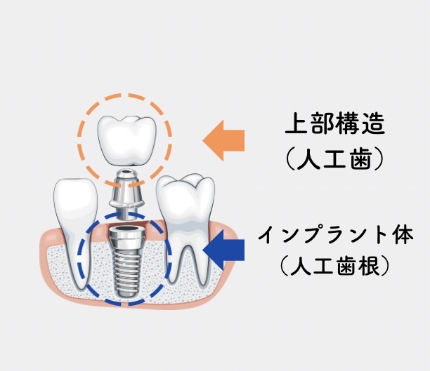 上部構造